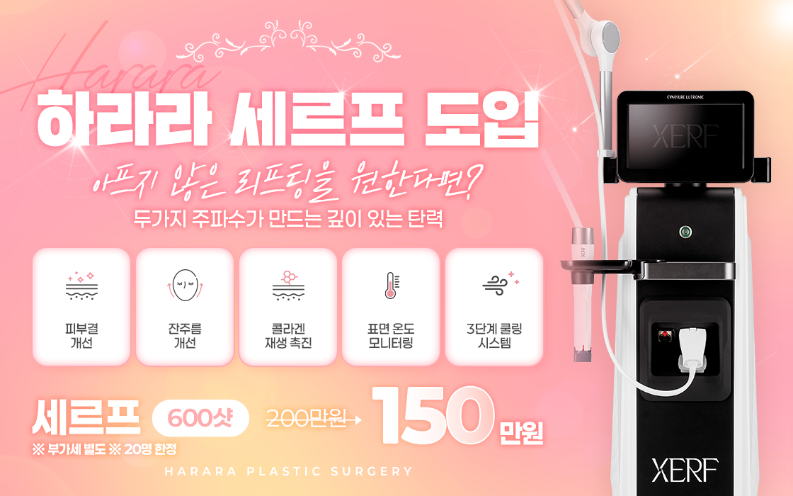 세르프도입